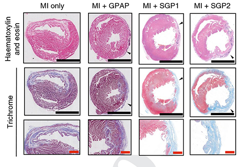 Ph: Nature Biomedical Engineering, A viscoelastic adhesive epicardial patch for treating myocardial infarction