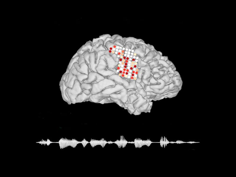 Posizionamento degli elettrodi ed esempio di segnale generato dalla rete neurale.Credits: UCSF