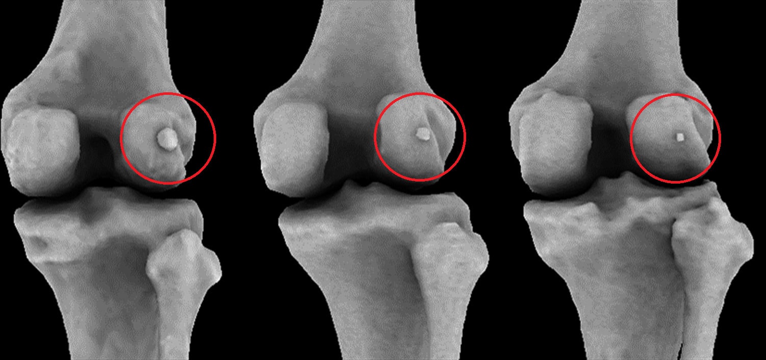 fabella, crediti: Journal of Anatomy