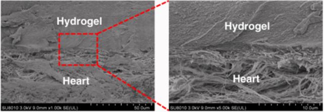 Immagine acquisita al microscopio SEM dell'interfaccia idrogel-feritacredits: nature.com
