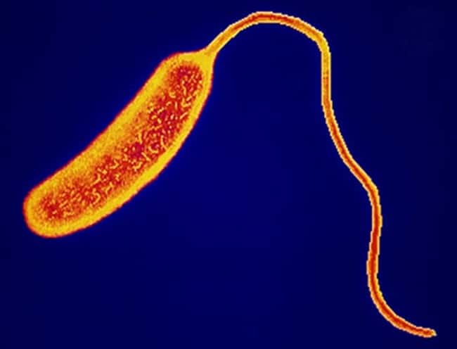 Il Vibrio Cholerae