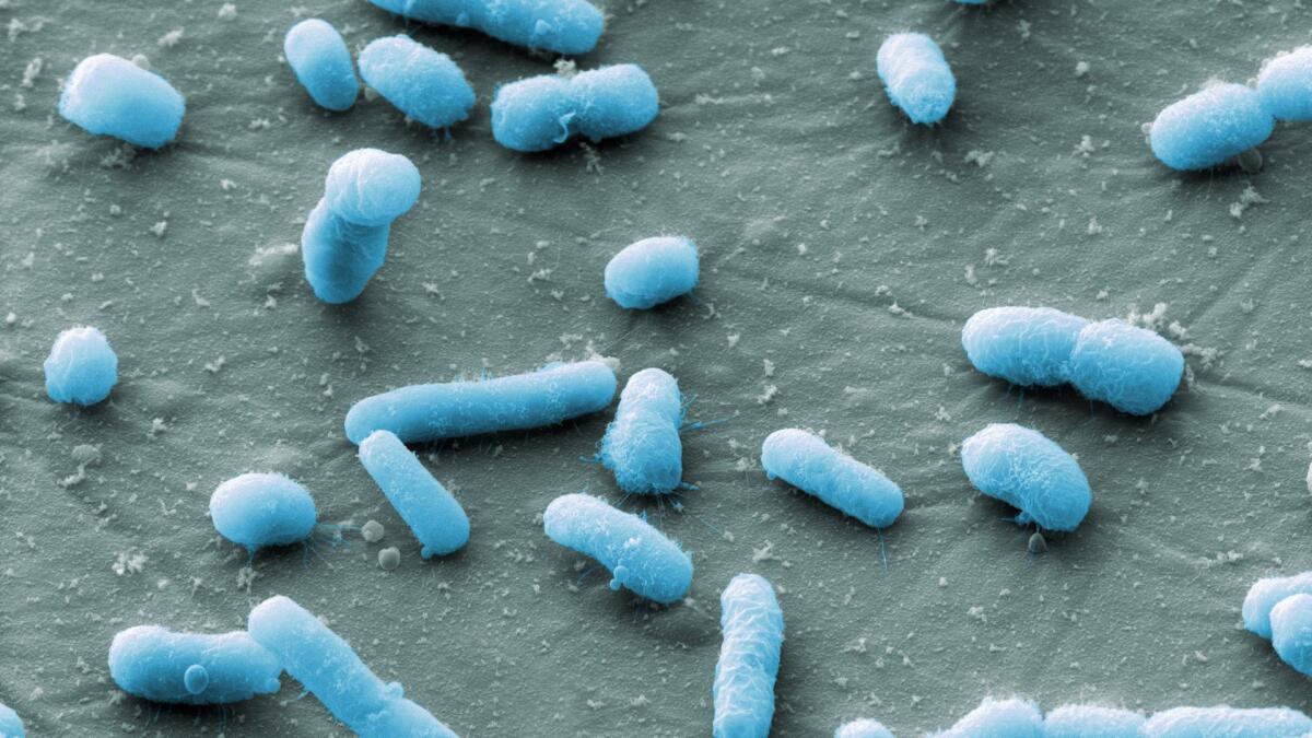 Creato primo batterio sintetico con Dna limitato e compresso - Escherichia coli, crediti: Microbiology from A to Z - Micropia