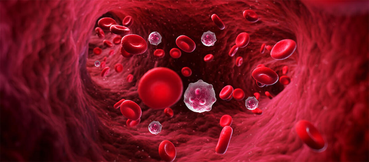 Un laser per scovare e distruggere le cellule tumorali nel sangue - Un laser per scovare e distruggere le cellule tumorali nel sangue
Image credits: Dr. Farrah cancer center