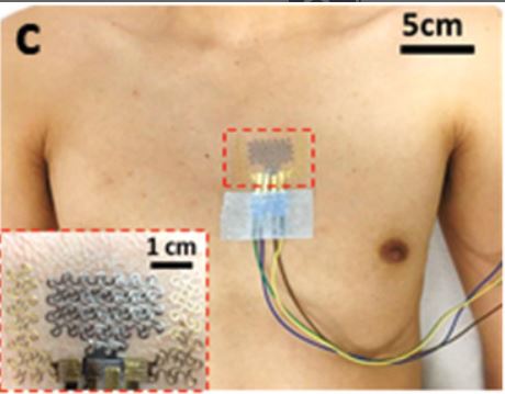 Posizionamento tatuaggio EMAC su torace uomo con fili da connessione
