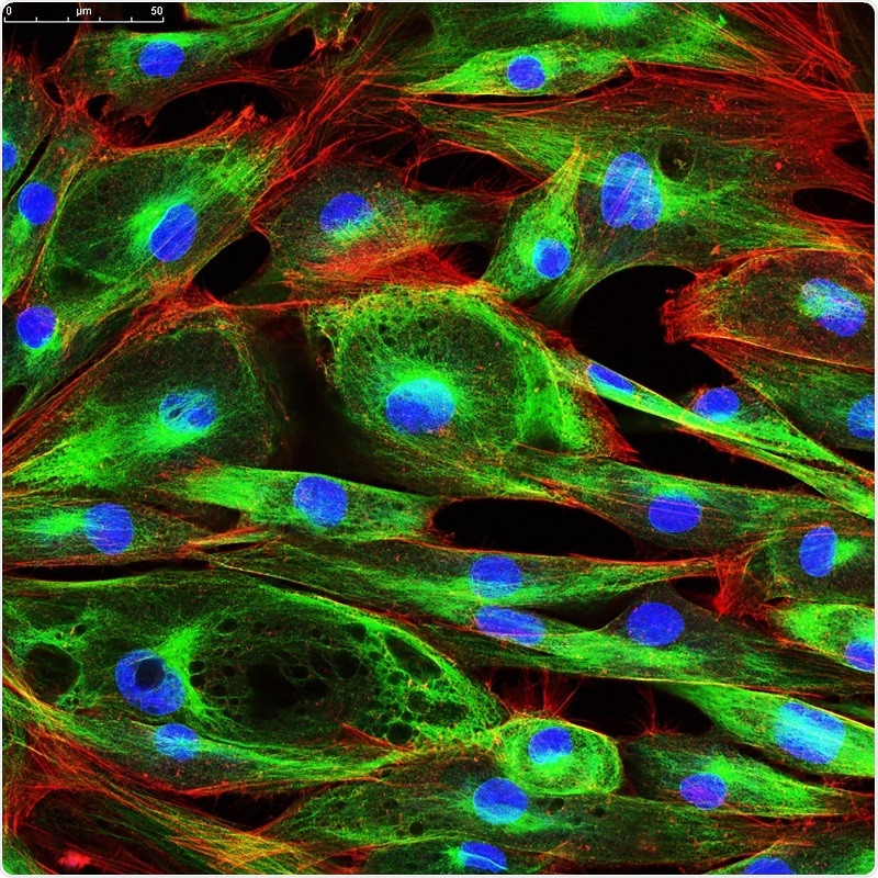 Microscopia confocale delle cellule del fibroblasto Ph: news-medical.net