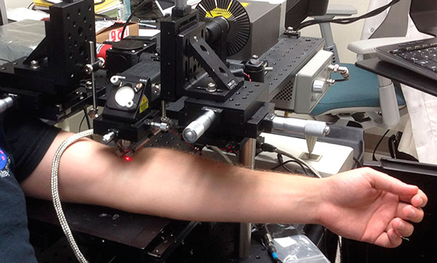 Fase di test del laser su pazienti affetti da melanomaCredits: E.I. Galanzha