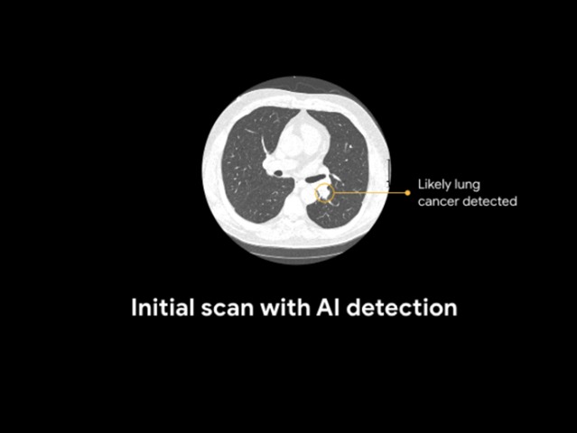 Scansione Google AIImage credits: Blog Google