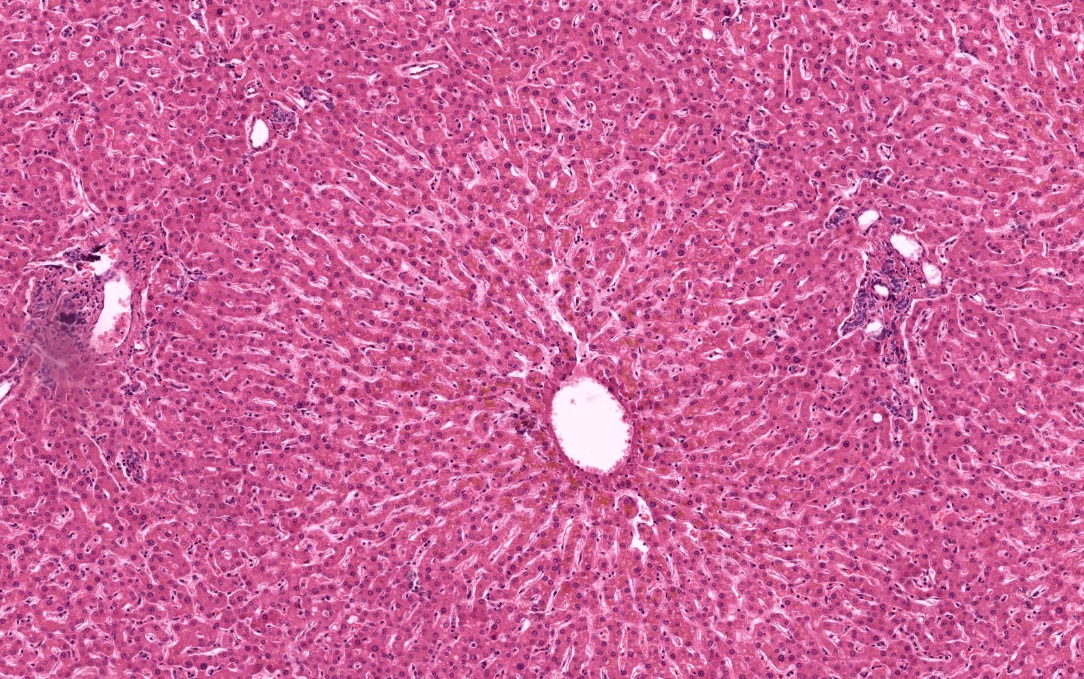 Nell'immagine possiamo apprezzare il tessuto epatico al microscopio ottico. Si apprezza un vaso venoso nel centro, la cosiddetta vena centrolobulare, il grande numero di epatociti formanti il lobulo epatico e, negli angoli di un poligono immaginario si ri
