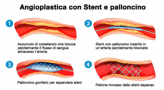 PH: staibene.it