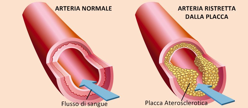PH:cardiochirurgia.com