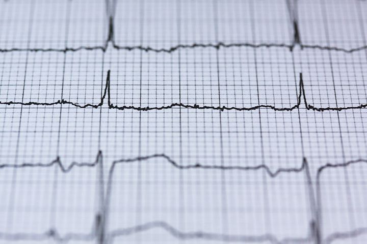La firma cardiaca è unica ed inimitabile