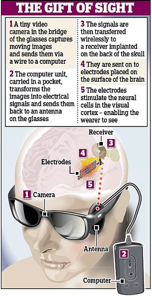 Occhio bionico OrionImage credits: Daily mail