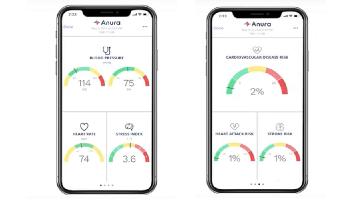 Schermata app Anura su smartphone per monitorare pressione sanguigna, battiti, livelli di stress, rischio di infartocredits: nurolagix.ai
