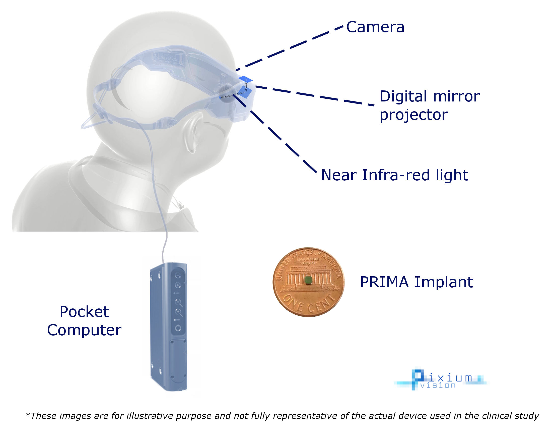 pixium-vision.com