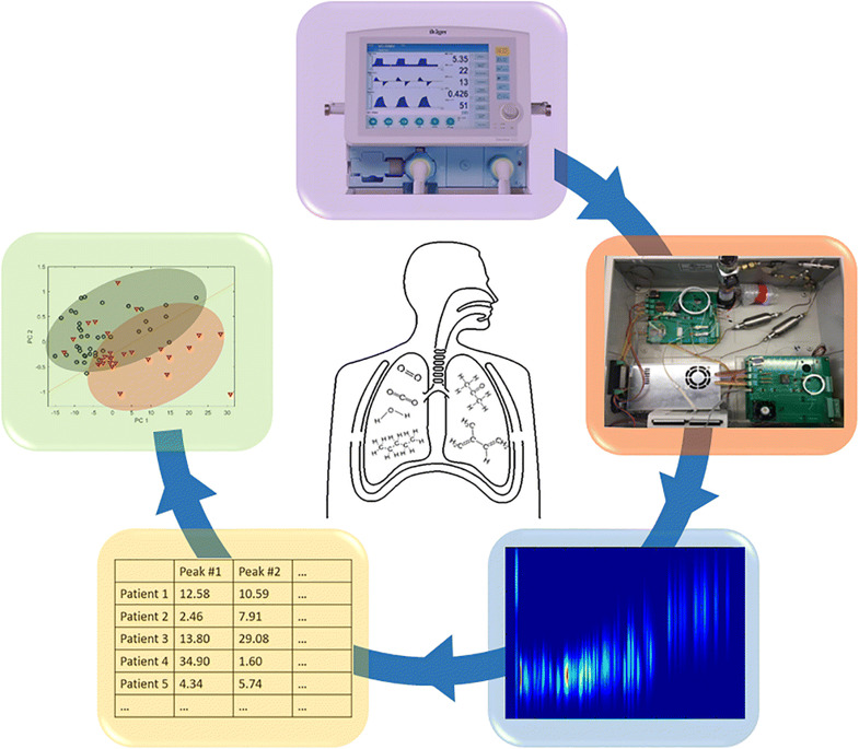Schematizzazione analisi del respiro per rilevare precocemente la sindrome da distress respiratorio acutocredits: umich.edu