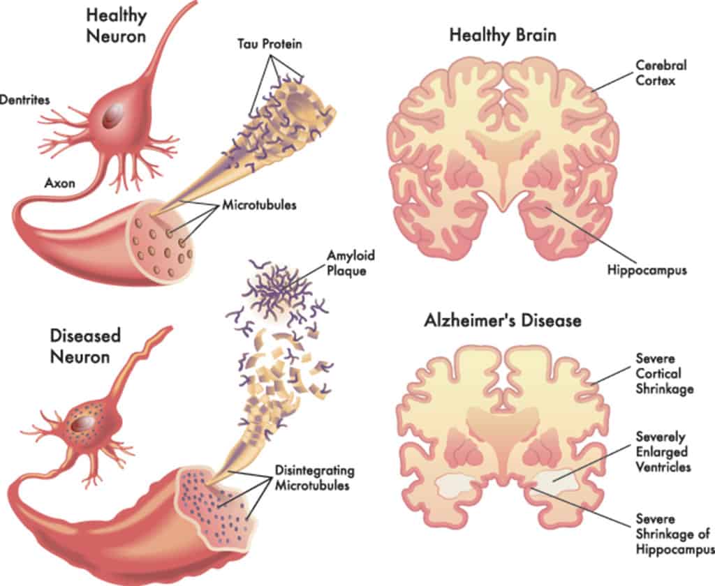 ©Neuroscienze.net
