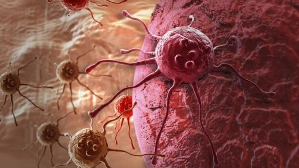 Tumori: possono davvero morire in microgravità? - Credits: repubblica.it