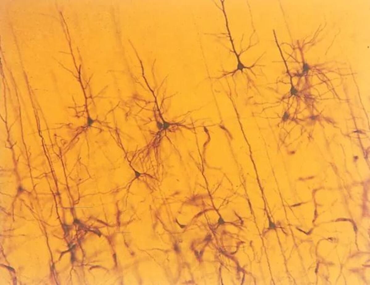 Quella volta che Camillo Golgi scoprì la forma dei neuroni - 