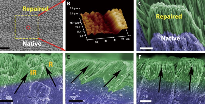 Immagini acquisite tramite microscopio SEM dello smalto dentale naturale e rigeneratocredits: advances.sciencemag.org