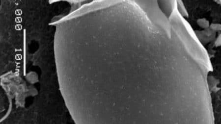 Specie di alga tossica presente nell'Oceano.Crediti: Stony Brook University
