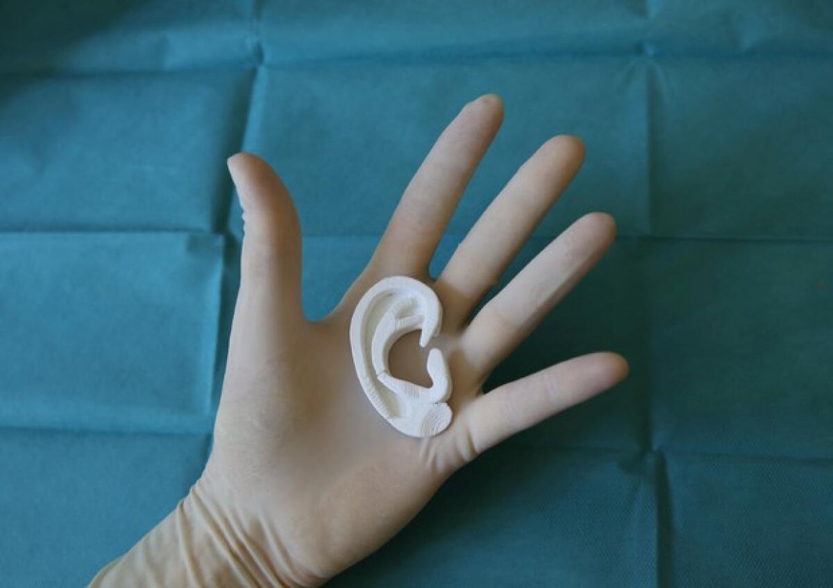 Stampa 3D: a Firenze ricostruito da zero l'orecchio ad un bambino - Stampa 3D: a Firenze ricostruito da zero l'orecchio ad un bambino
Credits: ANSA