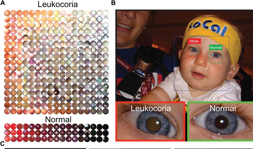 L'app cradle discretizza in matrici l'immagine da acquisire e ne studia la scala di colori.credits:advances.sciencemag.org