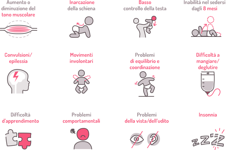 Sintomi della paralisi cerebrale infantili in neonati.Credits: nestlehealthscience.it