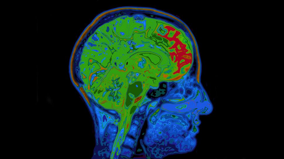 Usare intensamente il cervello serve a bruciare calorie? Crediti: Shutterstock