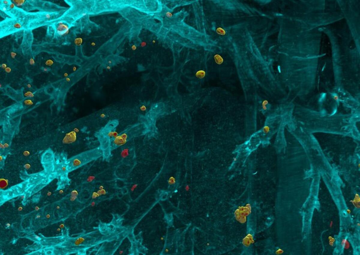 DeepMACT: l'algoritmo di deep-learning che rileva le metastasi invisibili - ansa.it