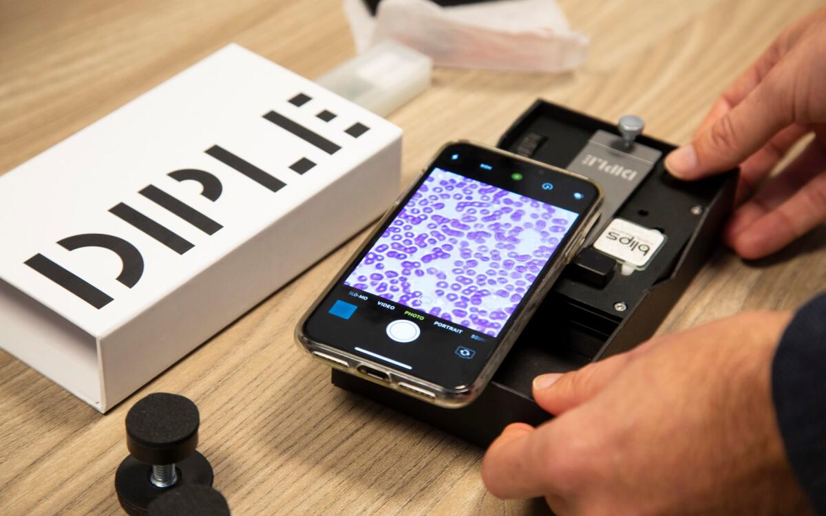 DIPLE: come trasformare uno smartphone in un microscopio portatile - 