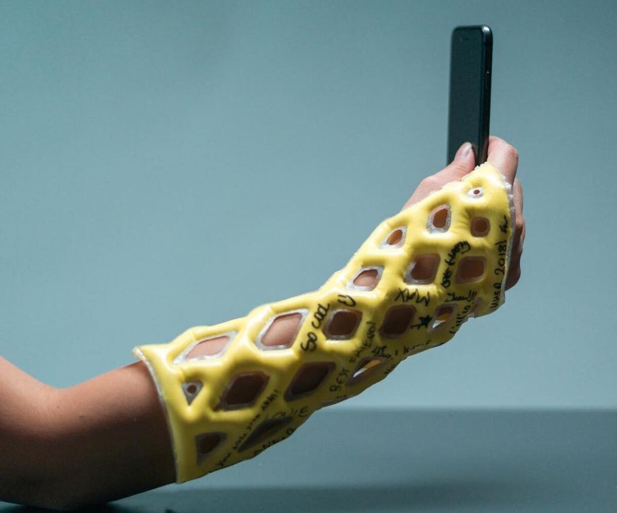 Il gesso del futuro? Un gesso ortopedico in resina che sembra un bracciale - Credits: https://www.cast21.com/