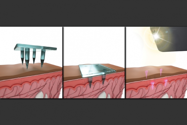 Illustrazione della procedura di vaccinazione Credits: MIT News