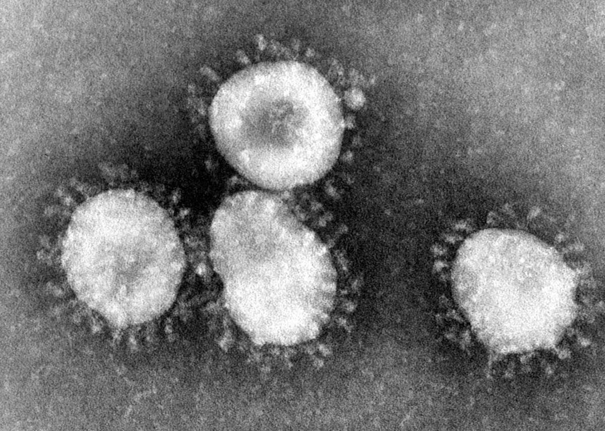 Coronavirus, morto dottore. Un'infermiera: '90mila contagiati' - Coronavirus, crediti: Content Providers(s): CDC/Dr. Fred Murphy - This media comes from the Centers for Disease Control and Prevention's Public Health Image Library (PHIL)