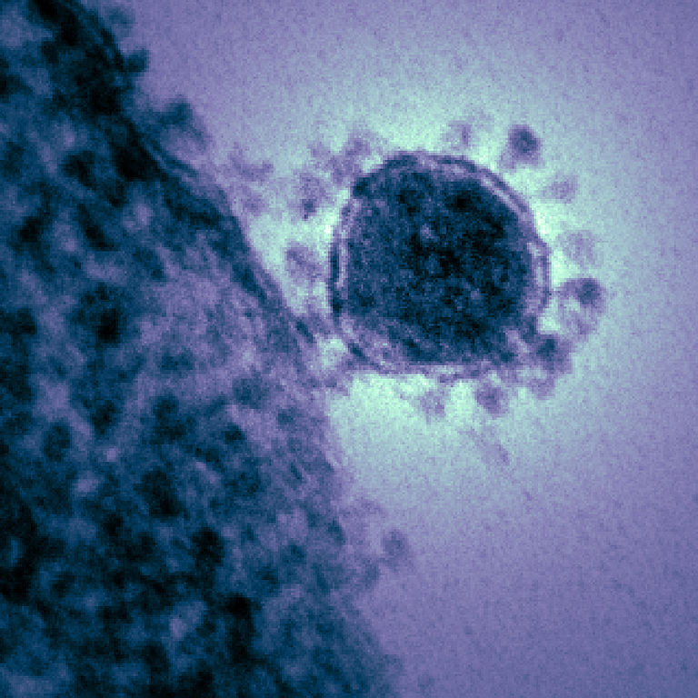 Il coronavirus Credits: National Institutes of Health (NIH)
