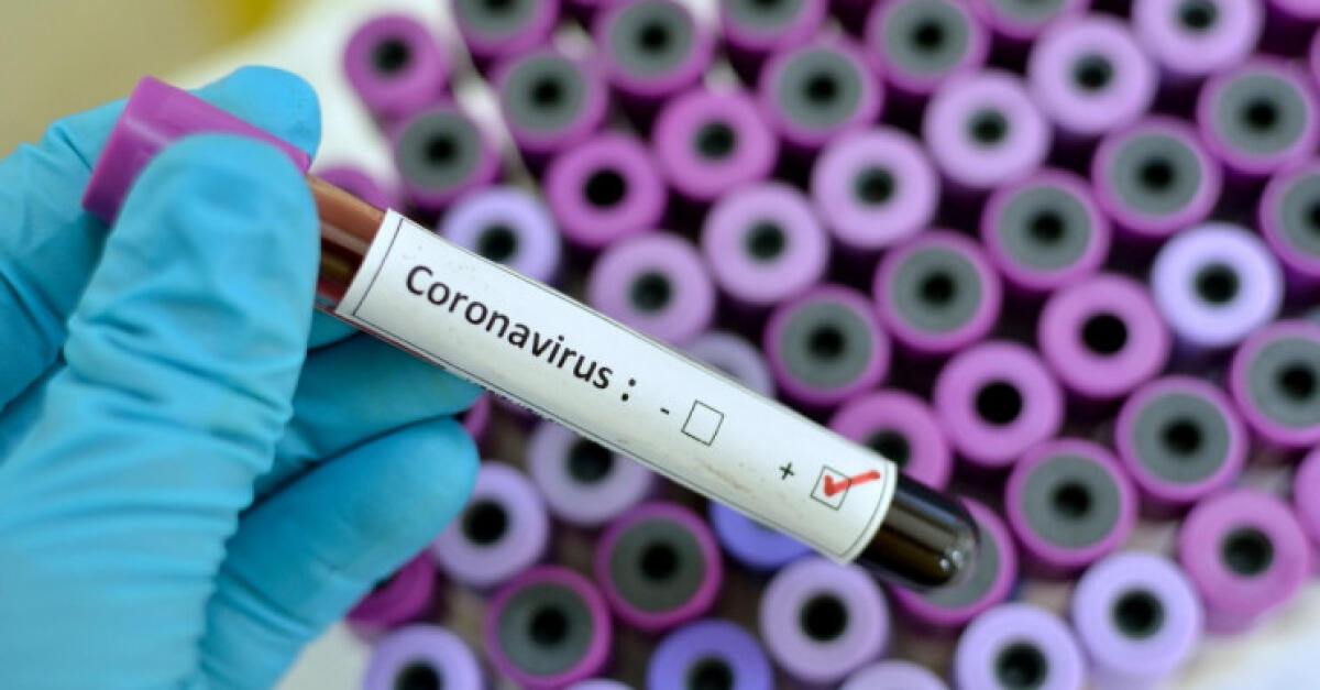 Coronavirus: in Cina arriva il test pronto in meno di 15 minuti - Coronavirus: in Cina arriva il test pronto in meno di 15 minuti
Credits: jarun011/iStock