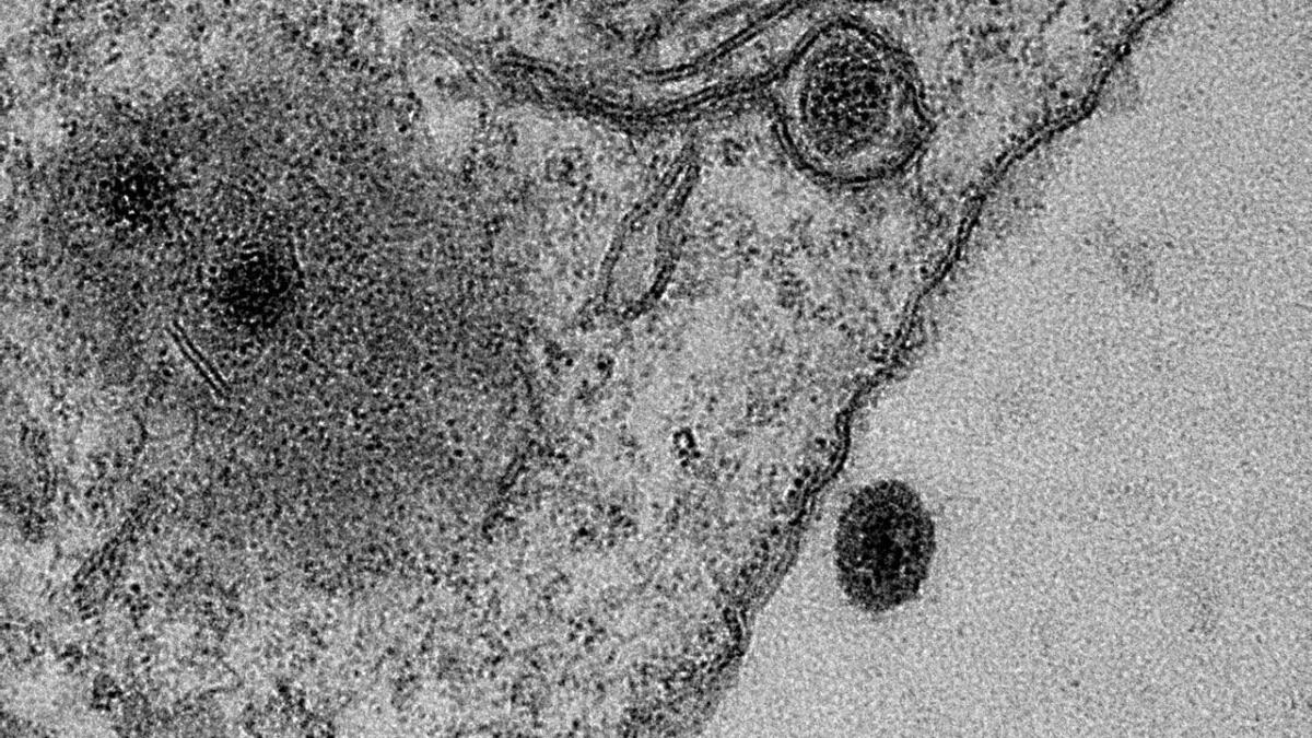 Yaravirus, il misterioso virus scoperto in Brasile: sconcertati gli studiosi - Yaravirus osservato al microscopio (crediti: J. ABRAHÃO AND B. LA SCOLA/IHU-MARSEILLE/MICROSCOPY CENTER UFMG-BELO HORIZONTE)