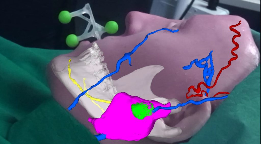 Sovrapposizione anatomia soggetto con manichino