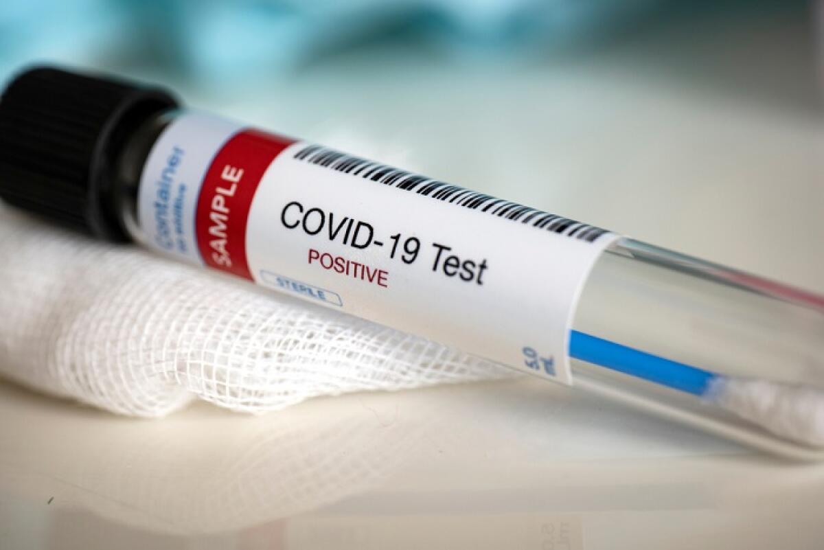 Tampone per covid19: come funziona, tempi e chi può sottoporsi - tampone coronavirus covid19 come funziona tempi italia