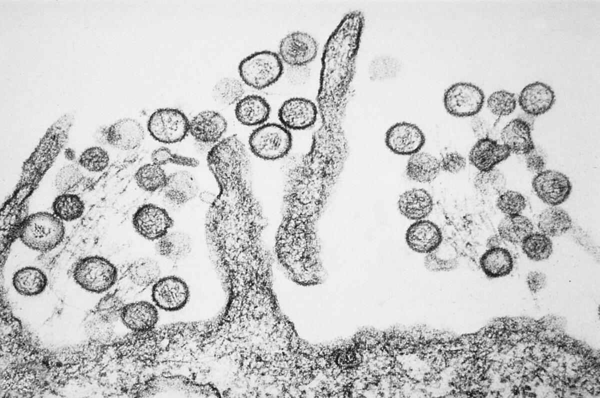 6 domande per capire cos'è l'Hantavirus - Hantavirus, crediti: Dominio Pubblico