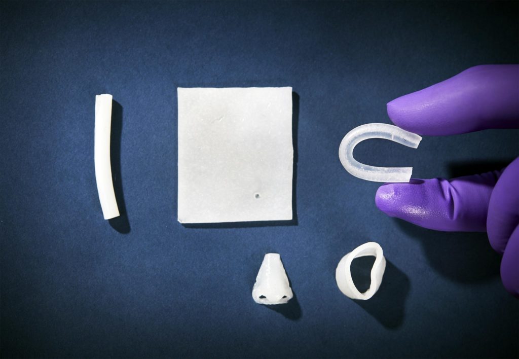 Il "naso" stampato in 3D nell'immagine è un esempio di come il materiale potrebbe agire come possibile sostituto della cartilagine. Credits: Anna Lena Lundqvist/Chalmers