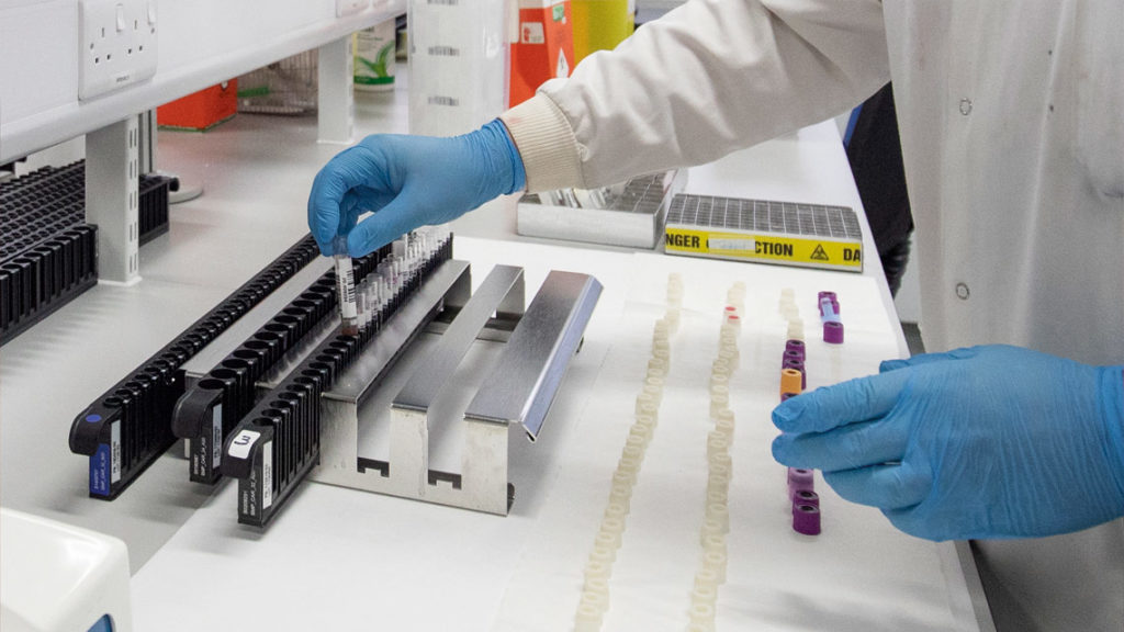 tampone coronavirus covid19 italia come funziona