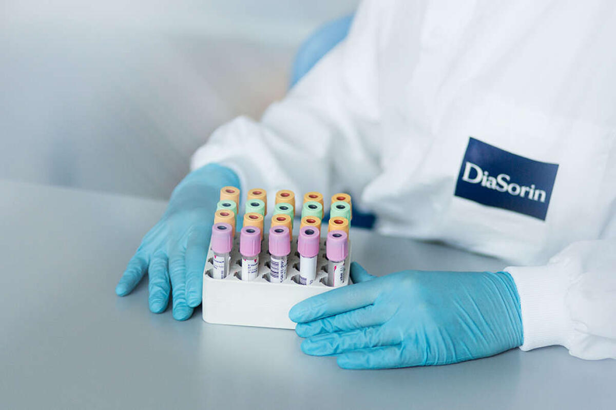 Coronavirus: DiaSorin, un'eccellenza italiana nella diagnostica - Coronavirus: DiaSorin, un’eccellenza italiana per la diagnostica. Credits: DiaSorin