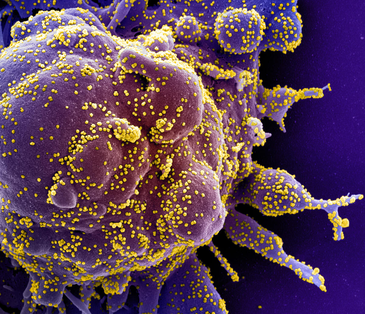 COVID-19: ottenuti due nuovi farmaci specifici - 