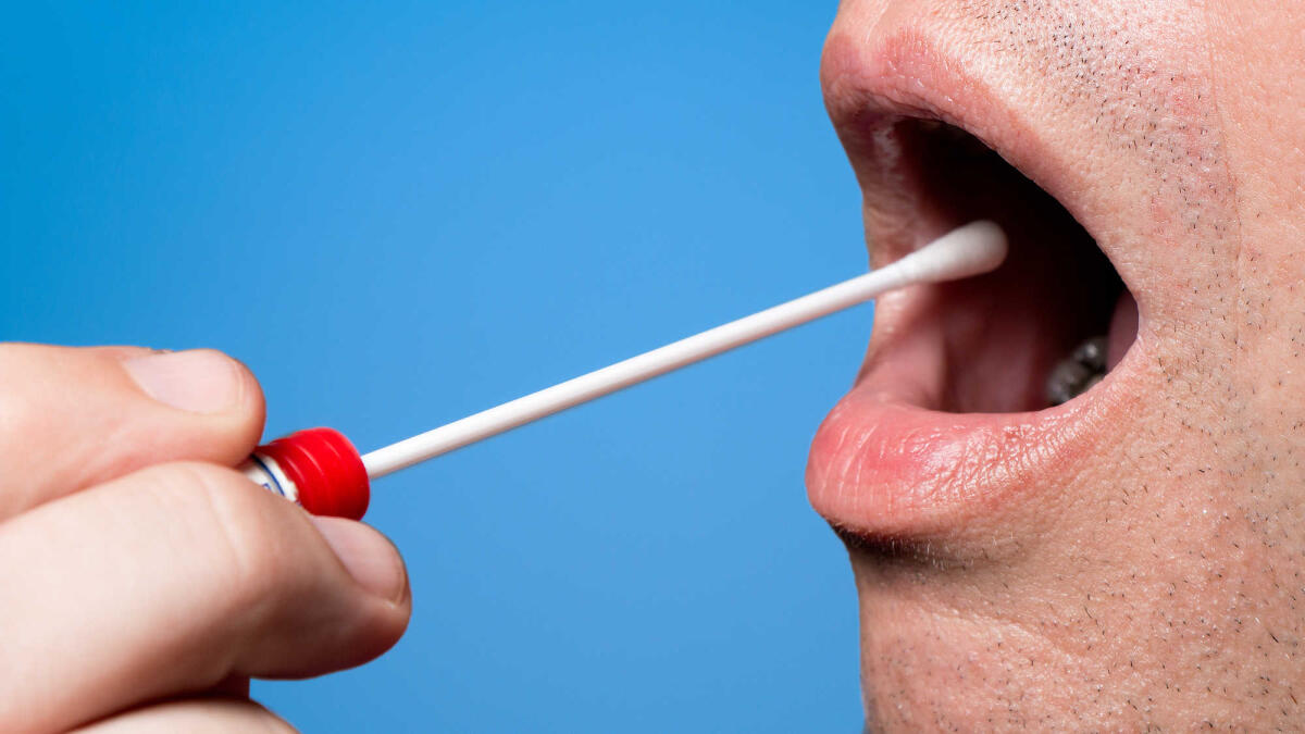 Un nuovo test della saliva per monitorare il diabete - PH: dental-tribune.com