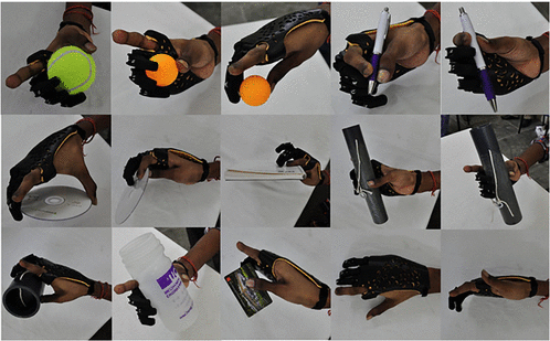 "Affordable passive 3D-printed prosthesis for persons with partial hand amputation" Alturkistani et al.
