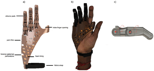 "Affordable passive 3D-printed prosthesis for persons with partial hand amputation" Alturkistani et al.