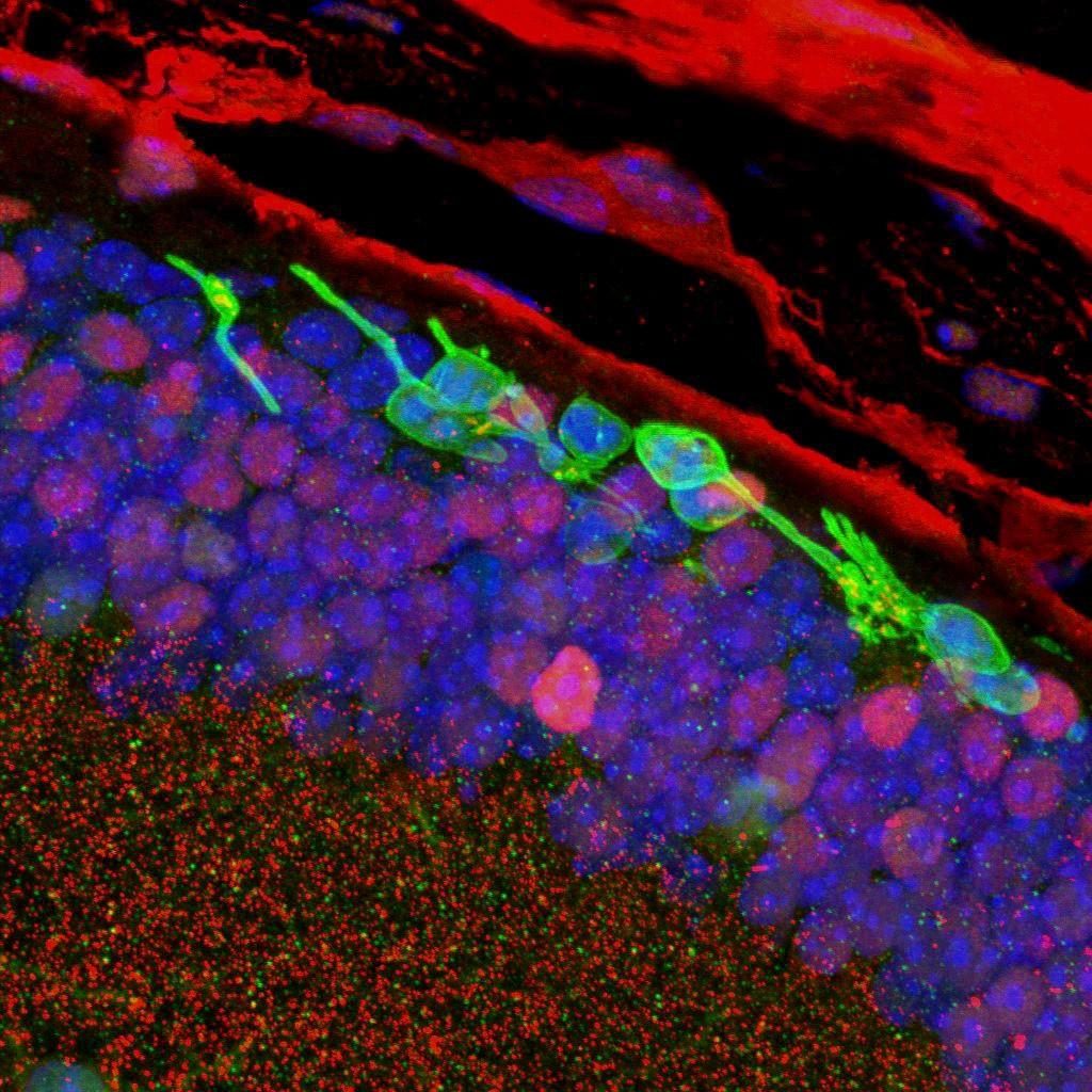 Tre mesi dopo il trapianto, studi in immunofluorescenza confermano la sopravvivenza dei fotorecettori (in verde). Credits: Sai Chavala.