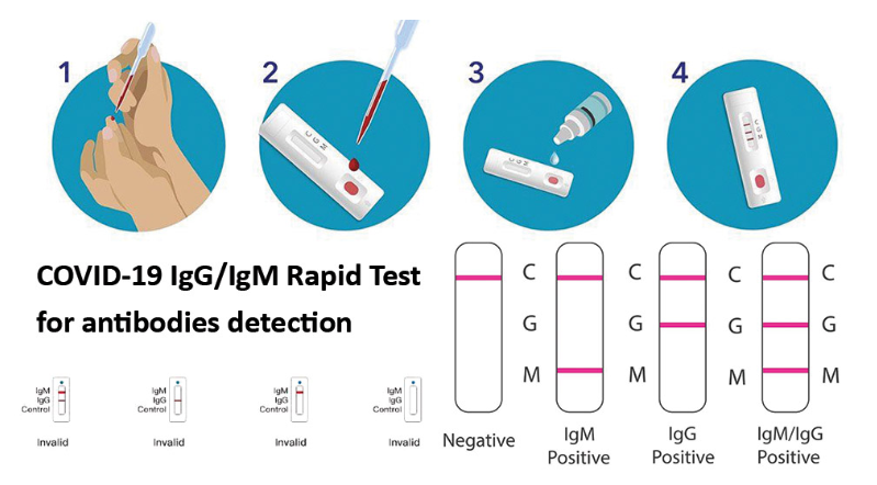 Test sierologico rapido per Covid-19: come funziona?