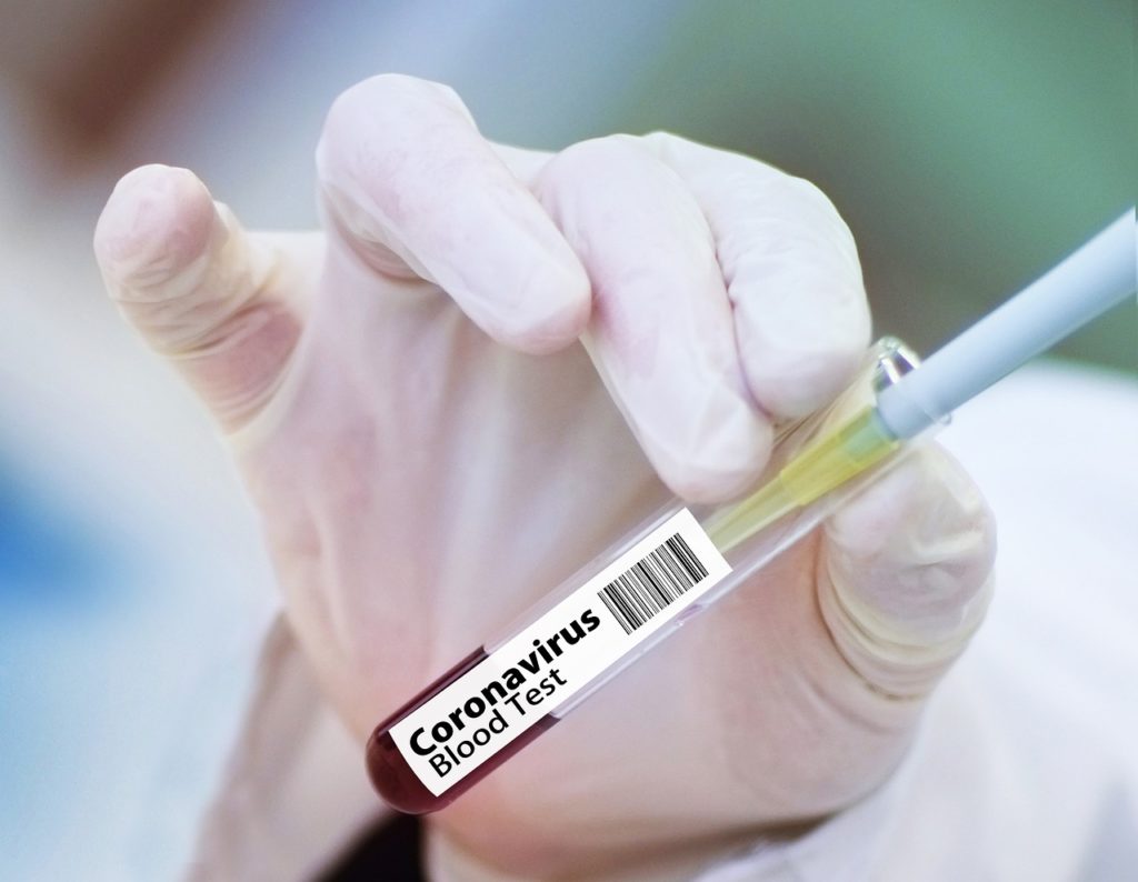 plasma terapia coronavirus