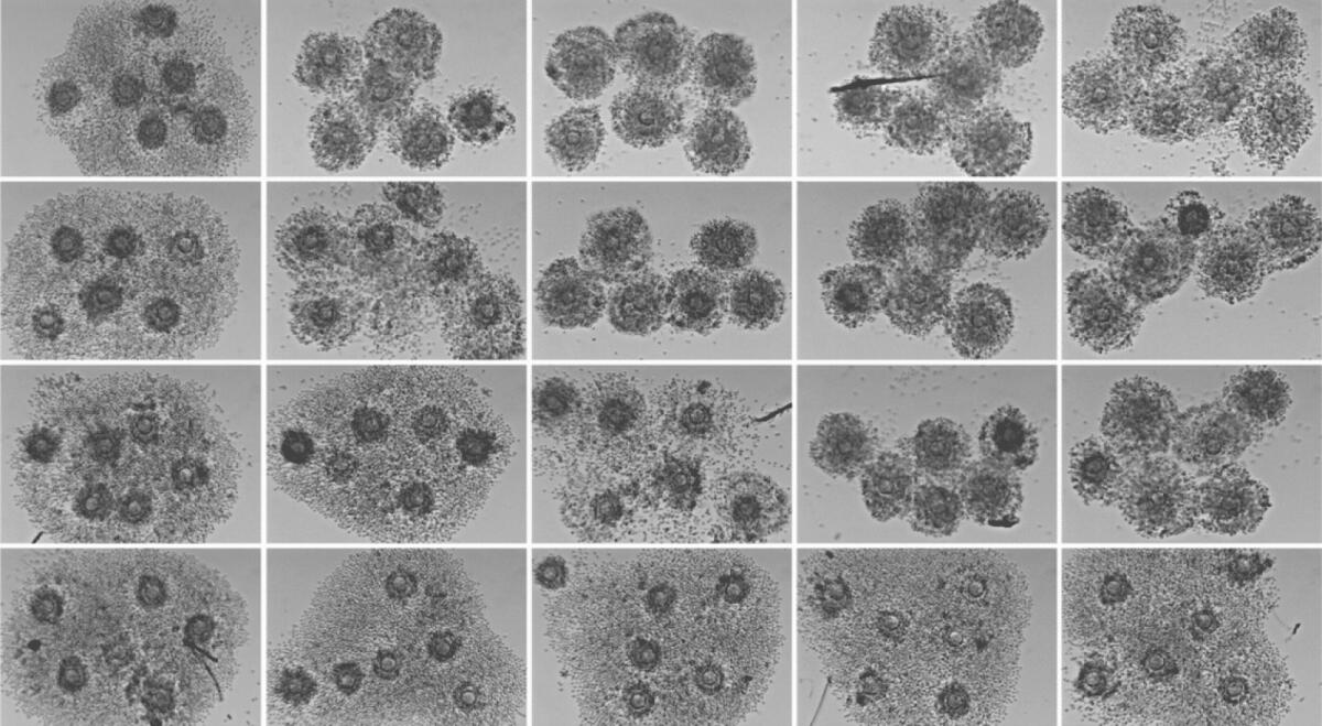 Coronavirus, Italia in prima linea con gli anticorpi monoclonali - crediti immagine: scienzainrete.it